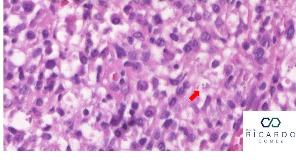 morfologia amastigota de leishmania